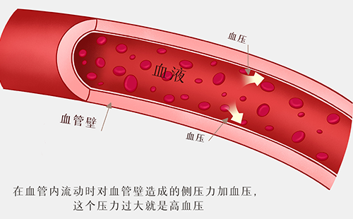 動(dòng)脈硬化檢測(cè)儀