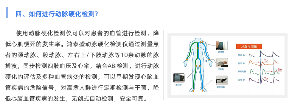 動(dòng)脈硬化檢測(cè)儀