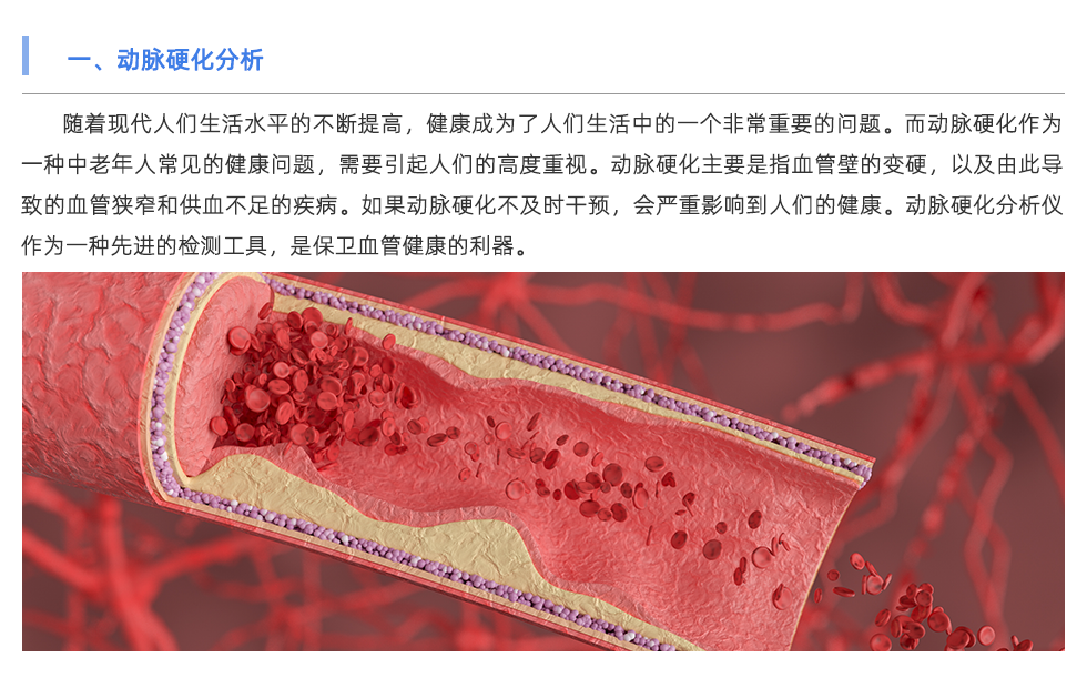 動脈硬化分析儀