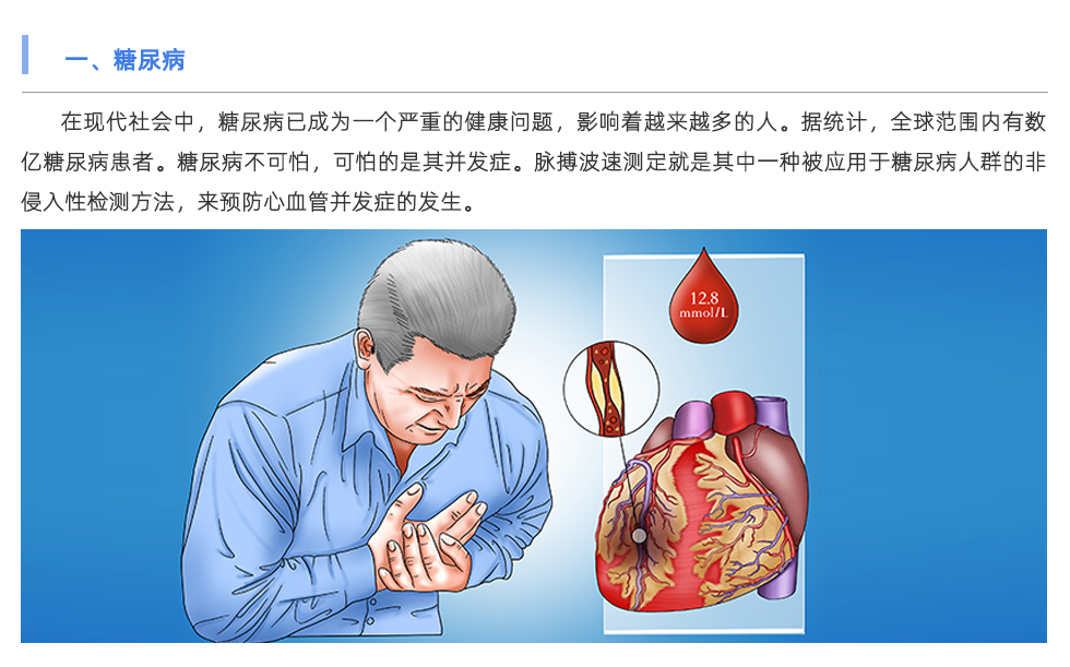 脈搏波速測定儀