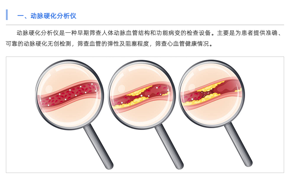 動(dòng)脈硬化分析儀