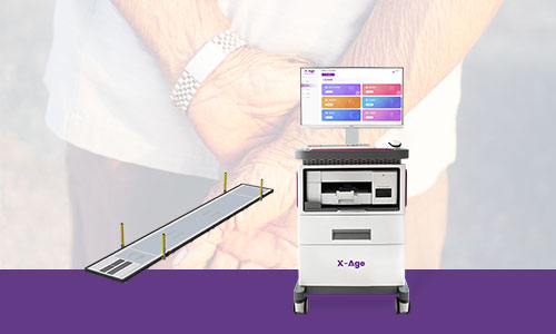 肌少癥風(fēng)險(xiǎn)評(píng)估儀